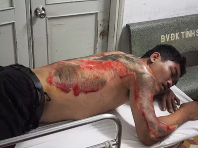 Yêu cầu giải quyết va chạm, tài xế taxi bị húc và kéo lê