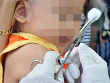 Chưa rõ nguyên nhân tai biến sau tiêm vắc-xin ở trẻ