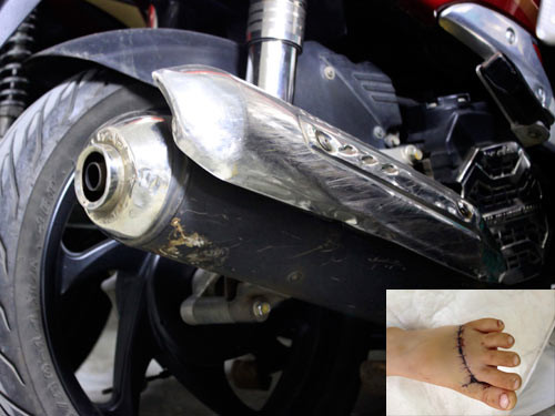 Tấm cản pô xe máy: ‘Máy chém’ trên đường