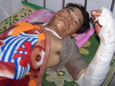 Lật xe trên đèo, 13 người thiệt mạng