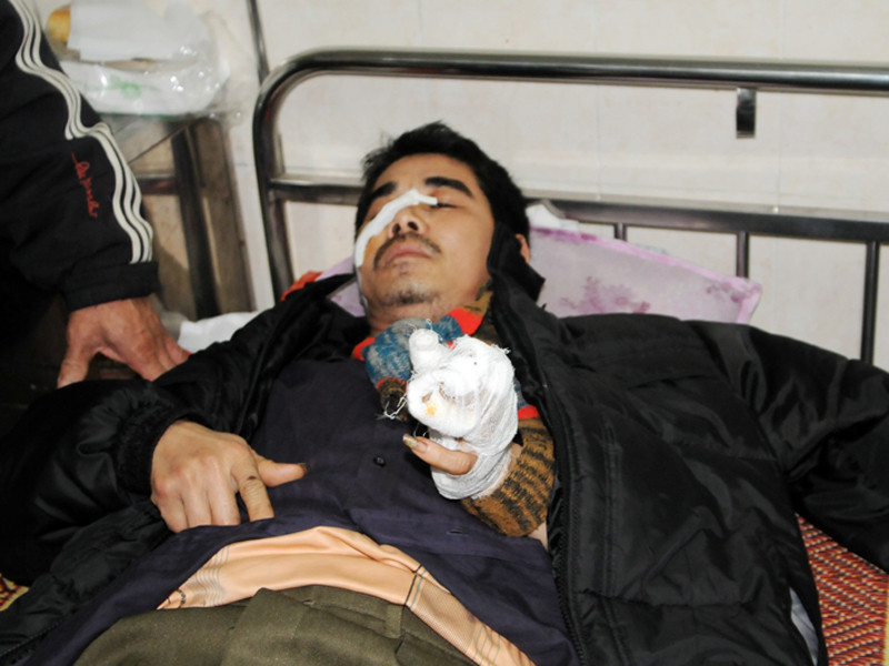 Giọt nước mắt của người cha bị con đánh