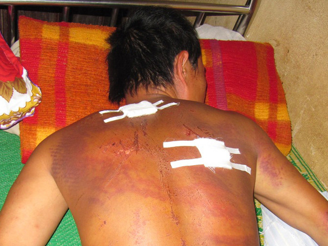 Chủ mỏ tra tấn người làm như thời trung cổ