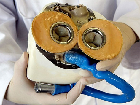 Lần đầu ghép tim nhân tạo hoạt động lâu dài