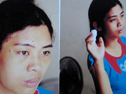 Chị Duyên với những vết thương sau khi bị cô em chồng đánh đập