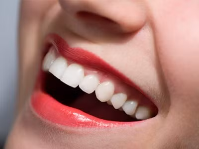 Bí mật giúp bạn có hàm răng trắng bóng hơn