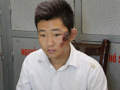 Clip: Lời khai của nhân viên 17 tuổi giúp bác sĩ vứt xác bệnh nhân