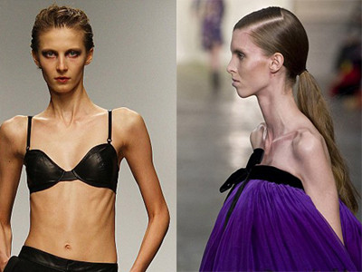 Hãi hùng 'những bộ xương di động' trên sàn catwalk