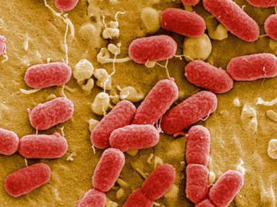 Bọn khủng bố gieo rắc dịch bệnh E.coli ở châu Âu?