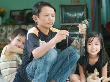 Bệnh lạ khiến 'cậu bé 33 tuổi' trẻ mãi