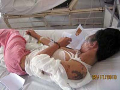 Đang chạy xe, thiếu nữ lãnh nguyên ca axit