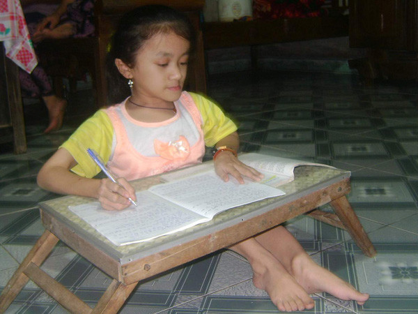 Học giỏi dù mắc bệnh xương thủy tinh