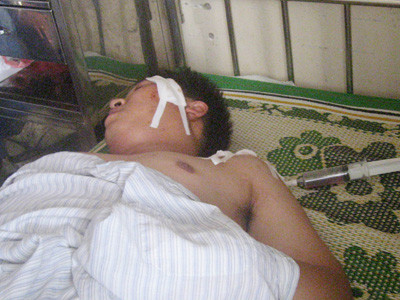 Báo động tình trạng côn đồ hành hung cảnh sát