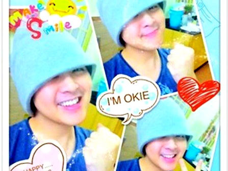 Hình ảnh Wanbi Tuấn Anh sau phẫu thuật