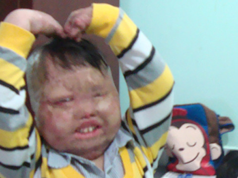 Cậu bé bị bố đốt và hành trình tìm lại tuổi thơ