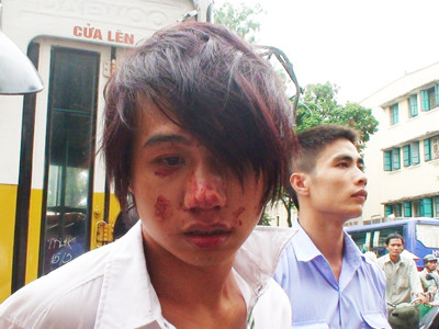 Tên cướp 9X bị bắt giữ