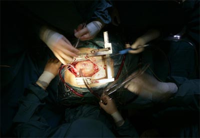 Việt Nam làm chủ kỹ thuật ghép tim