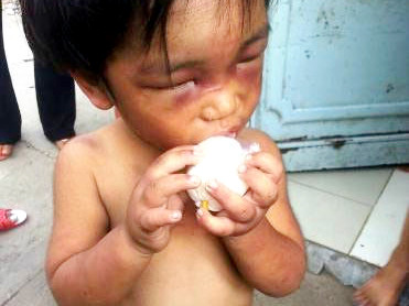 Cháu Đức ăn ngấu nghiến sau những ngày đói lả