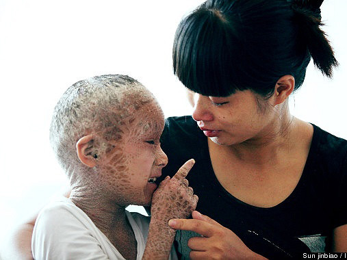 Rơi lệ hình ảnh 'em bé cá'