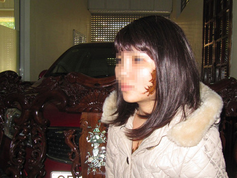 Thiếu nữ kể chuyện bị xăm 'quái vật' lên mặt