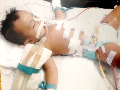 Bé Phụng đang được cấp cứu tại bệnh viện