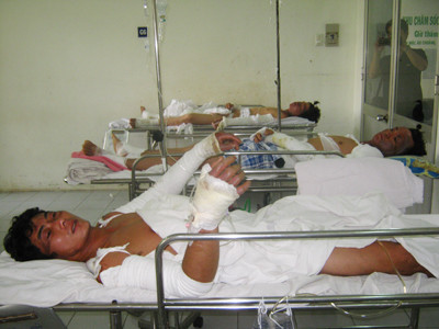 Tự chữa bỏng, rước họa vào thân