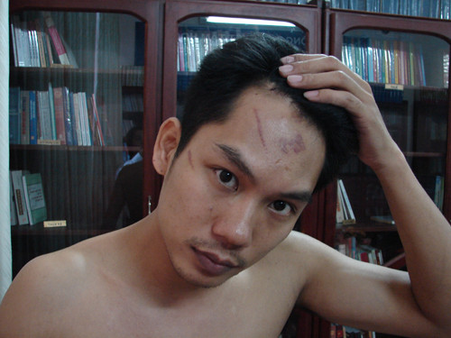 Nghi can chủ mưu bắn chết chủ doanh nghiệp ra đầu thú