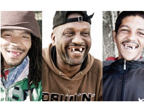 Kỳ quặc 'mốt' nhổ răng cửa... làm đẹp