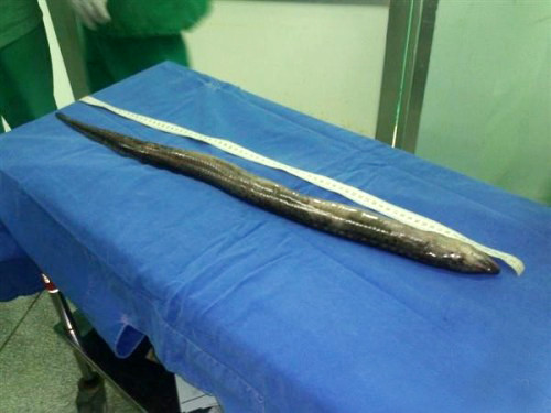 Nghịch dại, cá dài hơn nửa mét chui vào hậu môn