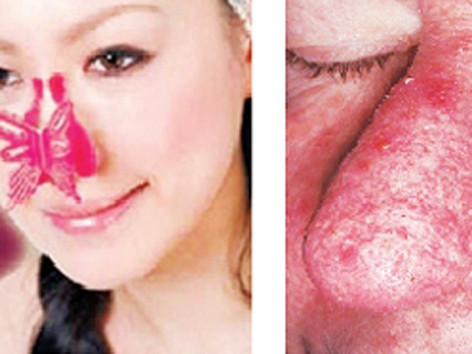 Bôi kem nở mông, to ngực coi chừng rước họa