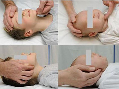 Phản ứng nhanh khi trẻ bị dị vật đường thở