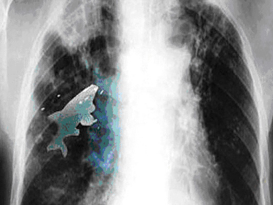 Cá bơi trong... phổi