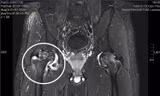 Bác sĩ ngoại quốc chẩn đoán sai, Việt kiều về nước được điều trị khỏi bệnh 