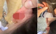 Xác minh vụ giáo viên tiểu học véo tai học sinh lớp 1 chảy máu ở Phú Quốc