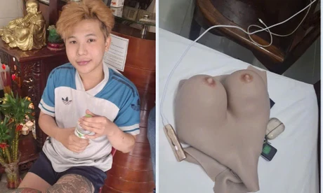 Nam thanh niên giả gái 'chat sex' để tống tiền hàng tỷ đồng