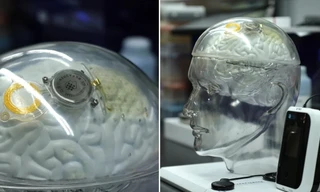 Trung Quốc thử nghiệm chip đọc não: Cạnh tranh nóng với Neuralink của Elon Musk