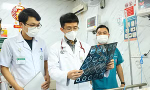 Đột quỵ rình rập khi trời lạnh: Những thời điểm nguy hiểm không thể chủ quan