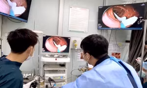 Sán dây dài gần 1 mét sống trong đại tràng người đàn ông có thói quen ăn đồ tái