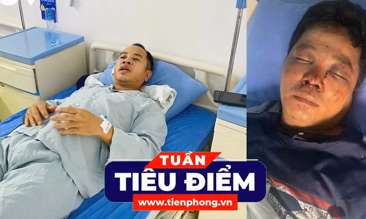 TIÊU ĐIỂM: Tuyên án bác sỹ hiếp dâm nữ bệnh nhân; Sức khoẻ 2 anh em bị đánh khi giúp người gặp nạn 