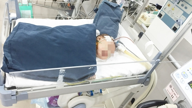 Bé Như tại khoa Hồi sức sau ca phẫu thuật