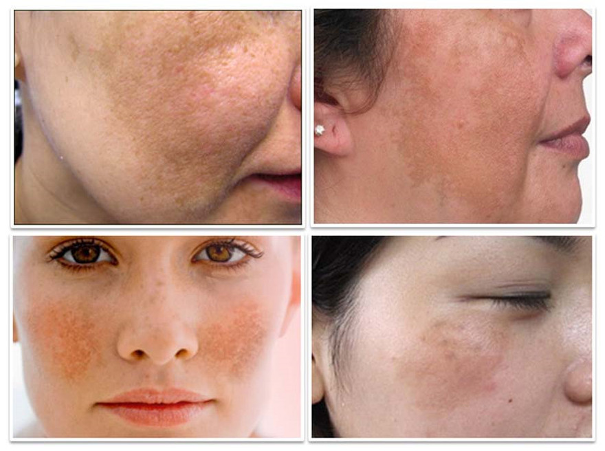 Ảnh minh hoạ: Internet