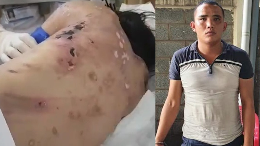 Nạn nhân với nhiều thương tật trên cơ thể và kẻ chủ mưu Lê Thế Diện