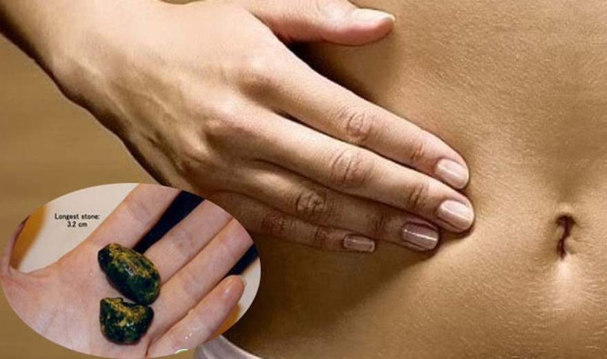 Ảnh minh hoạ: Internet