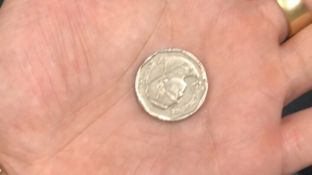 Đồng xu sau khi được các BS lấy ra khỏi đường thở của bé Quân. Ảnh: BV Nhi Trung ương