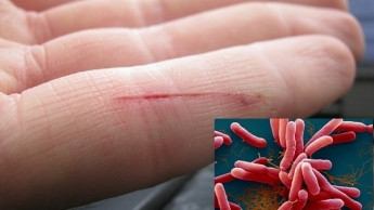 Ảnh minh họa: Internet