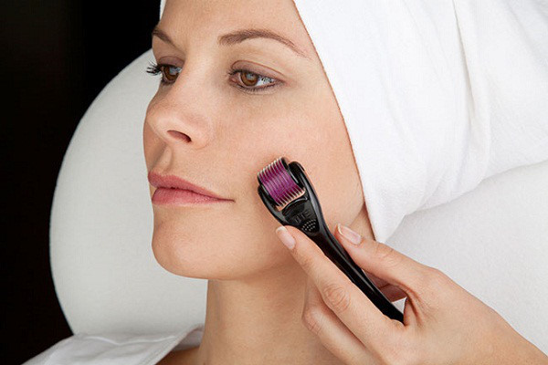 Lăn kim làm đẹp là phương pháp nguy hiểm, có thể nhiễm nhiều căn bệnh chết người. Ảnh minh hoạ: Internet