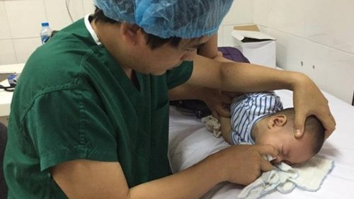 BS Xương hướng dẫn cách rửa mũi cho trẻ