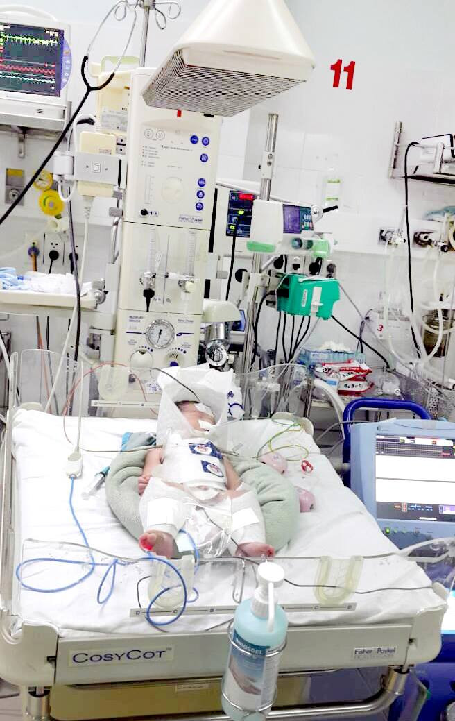 Trẻ sơ sinh được cứu sống nhờ... 'làm lạnh'