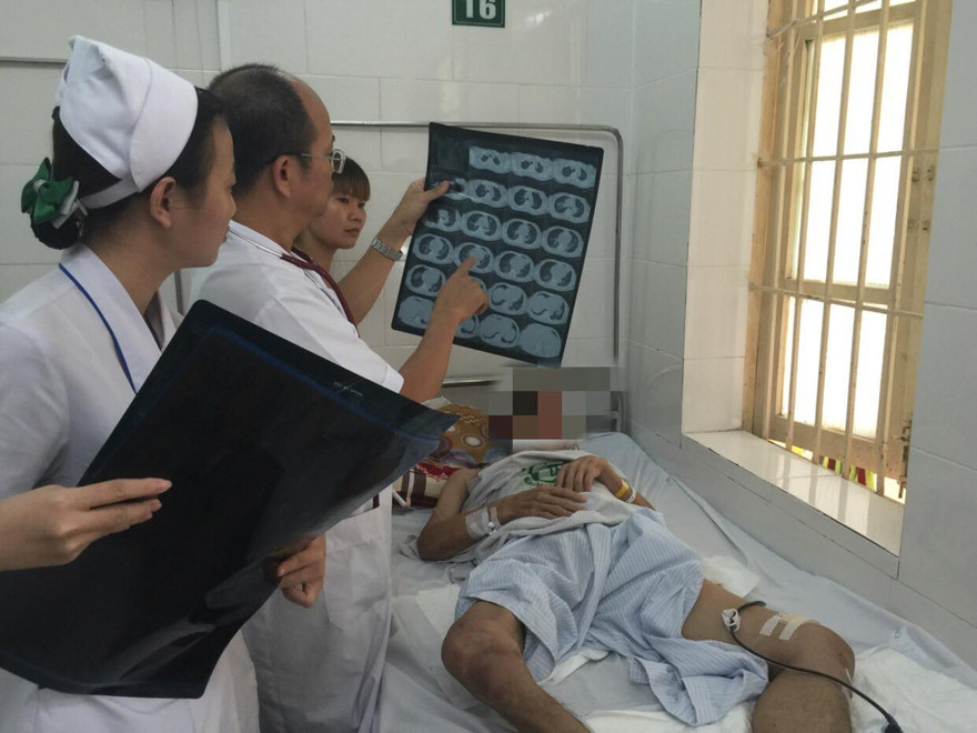 PGS.TS Đỗ Duy Cường thăm khám cho bệnh nhân whitmore. Ảnh: BV Bạch Mai cung cấp