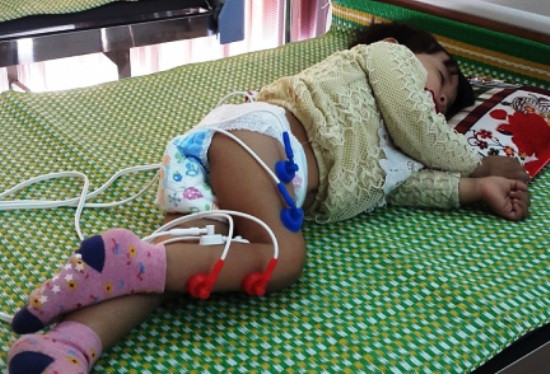 Chuyên gia y tế nhận định cháu bé mắc phải hội chứng Guillain-Barré, hội chứng mà y học rất hạn chế trong việc điều trị. Ảnh: Anh Khắc Tạo chia sẻ trên facebook