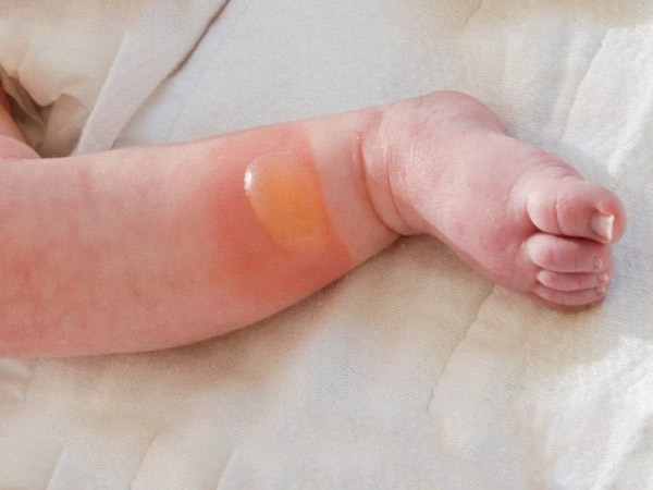 Ảnh minh họa: Internet